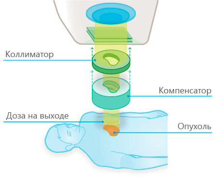 Принцип протонно-лучевой терапии